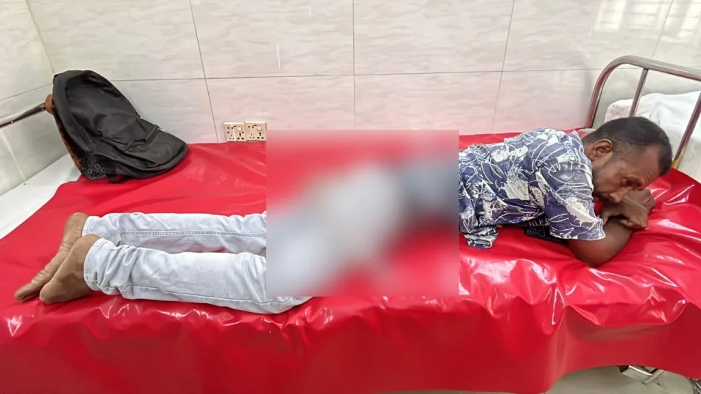 কুমিল্লায় কিশোর গ্যাং হামলা, যুবকের পায়ে চাইনিজ কুড়াল বিদ্ধ